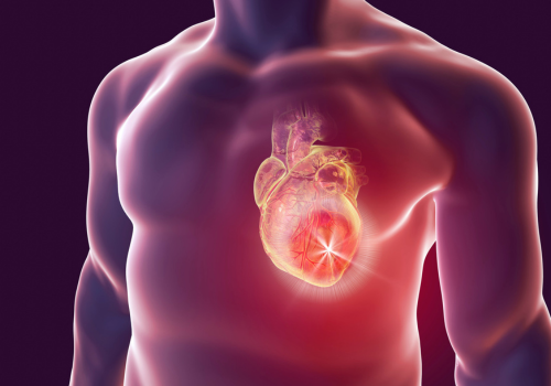 Cardiac Surgery in Chandigarh